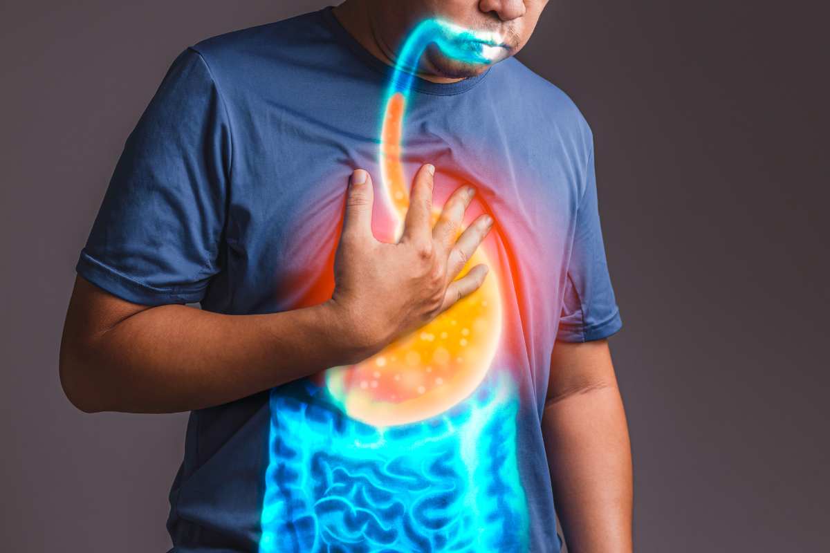 Come prevenire e ridurre i sintomi del reflusso gastrico