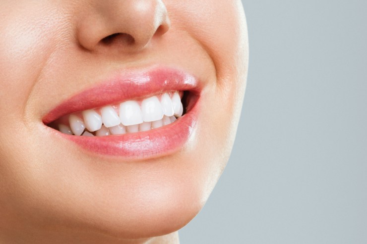 trend TikTok da evitare sulla dentatura