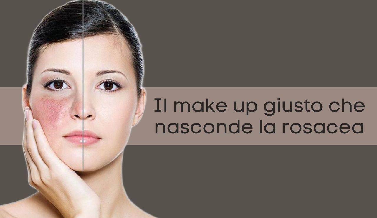 Il make up contro la rosacea