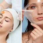 Peeling chimico