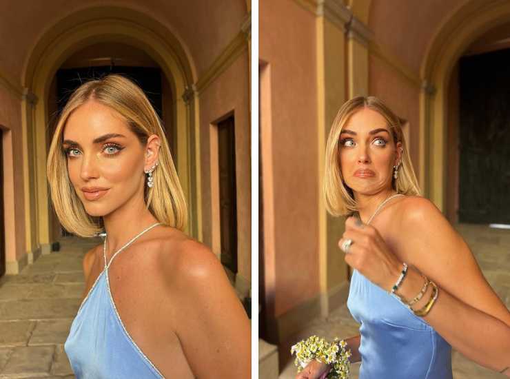 chiara ferragni botox - modaeimmagine.it