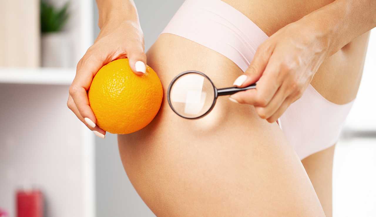 cellulite cuscinetti adiposi - modaeimmagine.it