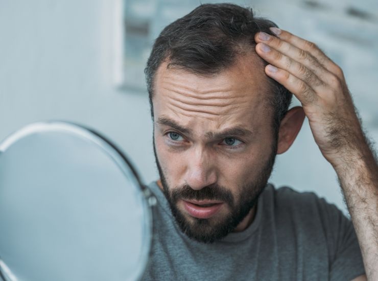 Uomo con alopecia che si guarda allo specchio 