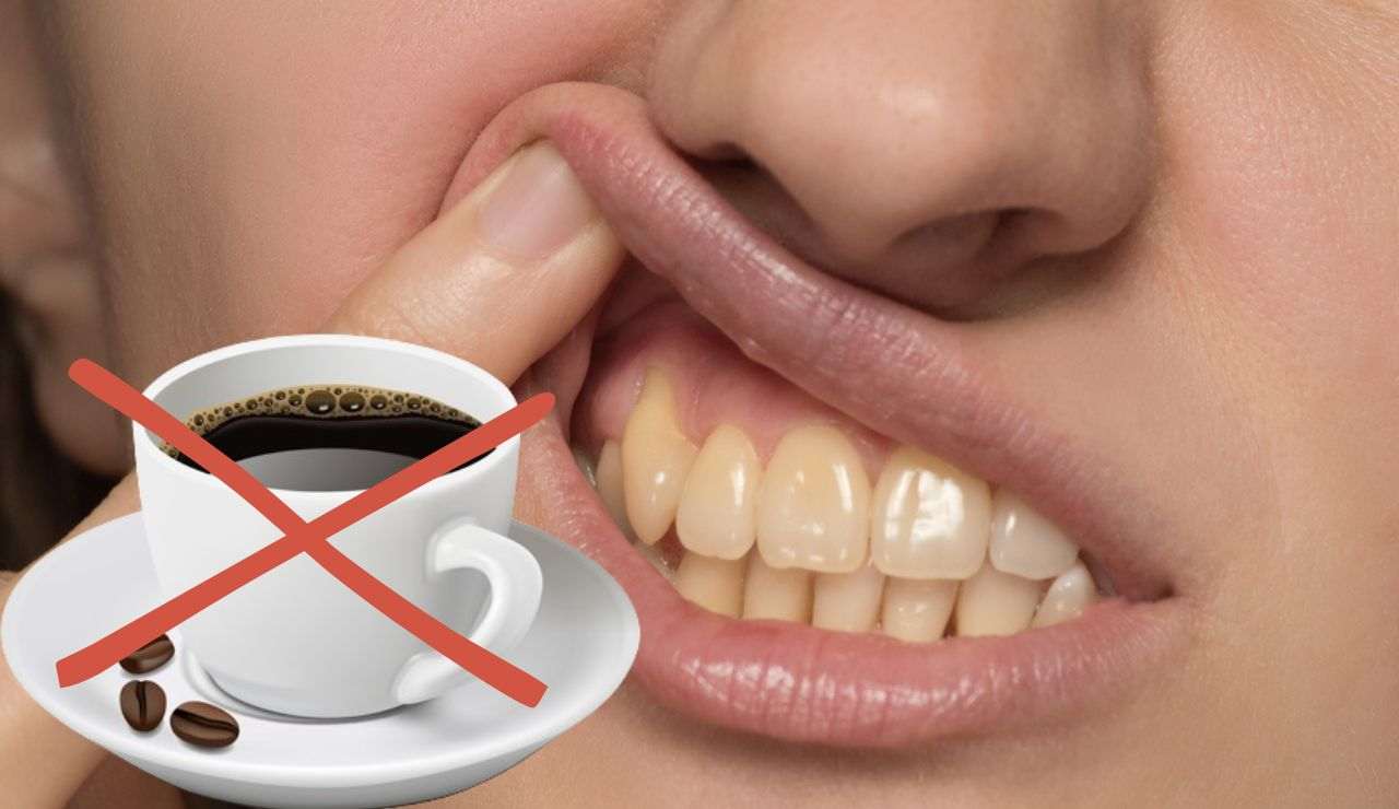 Primo piano di donna con denti gialli e tazzina caffè sbarrata con una X